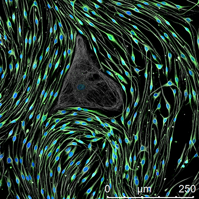 rat schwann cells.jpg